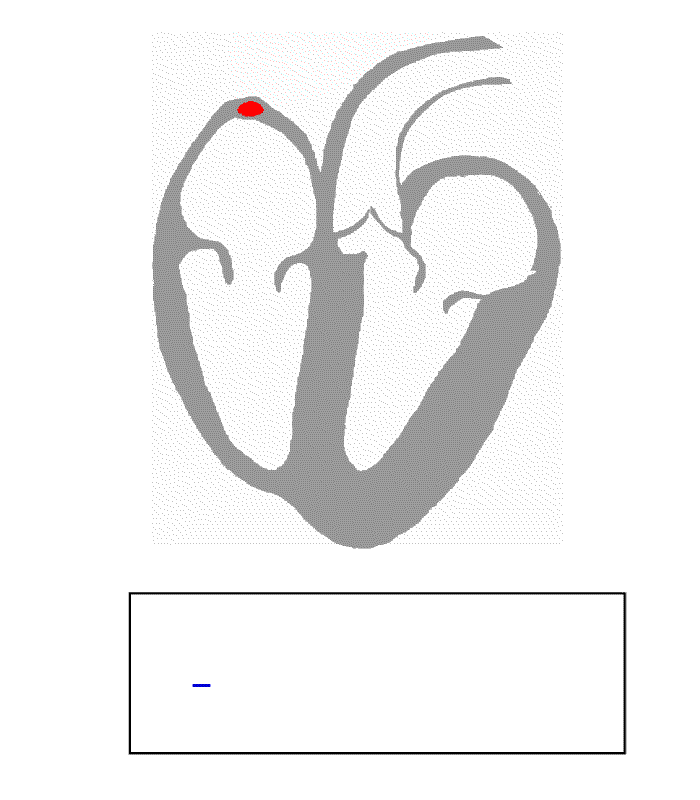 心电图波形产生过程的动画 \[1\]